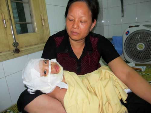 Vụ nổ quán bia ở Cầu Giấy: 3 nạn nhân vẫn nguy kịch - 1