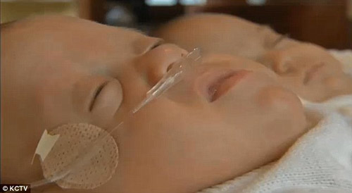 Cặp song sinh chào đời cách nhau... 39 ngày - 8