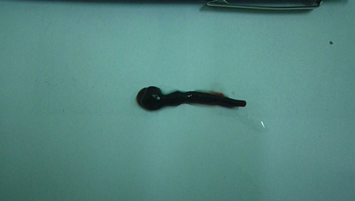 Con sên dài khoảng 3cm chui vào mũi em bé - 1