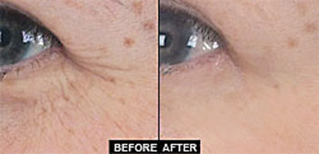 Chuyên gia #039;tung chiêu#039; giúp trẻ hóa không cần botox, phẫu thuật - 4