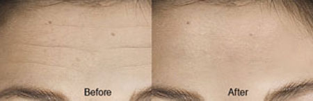 Chuyên gia #039;tung chiêu#039; giúp trẻ hóa không cần botox, phẫu thuật - 5