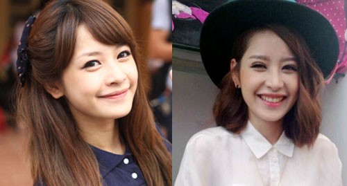 Sao Việt #039;lao tâm khổ tứ#039; vì biến chứng phẫu thuật thẩm mỹ - 1