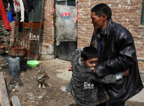 Cậu bé 12 tuổi không biết nói vì bị nhốt cùng mẹ tâm thần - 2