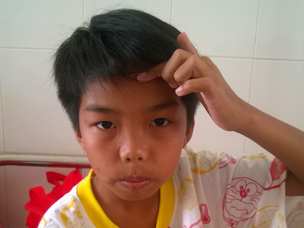 CA xã “bị tố đánh HS lớp 7 nhập viện” xin nghỉ dài hạn - 1