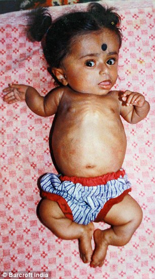 Thiếu nữ 19 tuổi quot;kẹt” trong hình hài trẻ 2 tuổi - 4