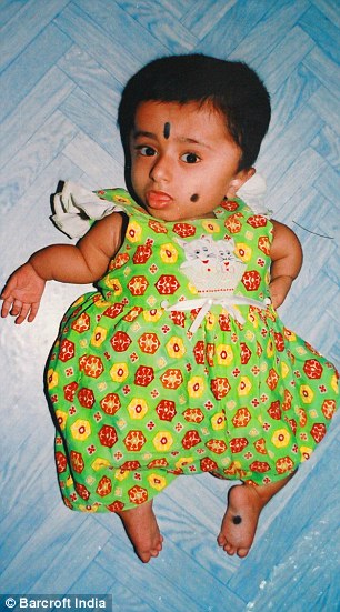 Thiếu nữ 19 tuổi quot;kẹt” trong hình hài trẻ 2 tuổi - 5