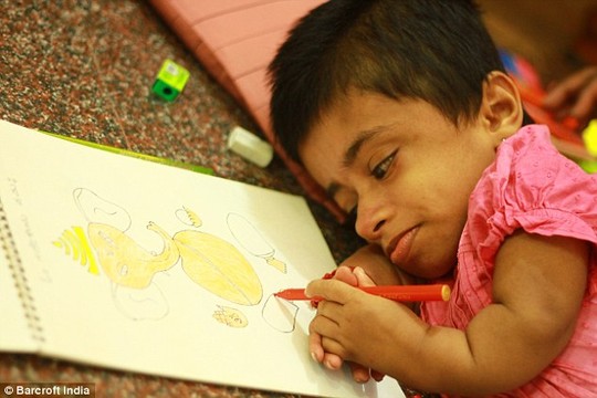 Thiếu nữ 19 tuổi quot;kẹt” trong hình hài trẻ 2 tuổi - 1