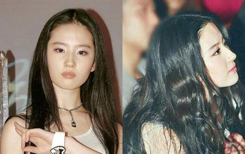 Sao Hoa ngữ đối diện với #039;vấn nạn#039; rụng tóc - 2