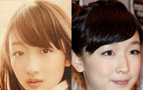 Sao Hoa ngữ đối diện với #039;vấn nạn#039; rụng tóc - 9