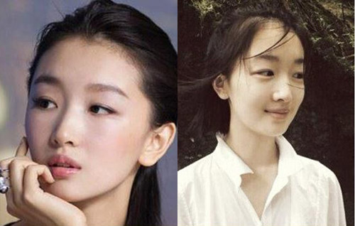 Sao Hoa ngữ đối diện với #039;vấn nạn#039; rụng tóc - 8