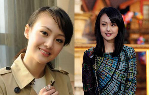 Sao Hoa ngữ đối diện với #039;vấn nạn#039; rụng tóc - 10