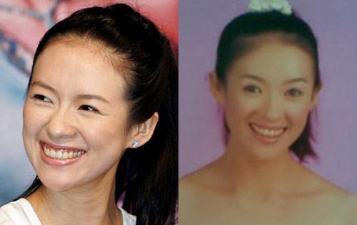 Sao Hoa ngữ đối diện với #039;vấn nạn#039; rụng tóc - 12