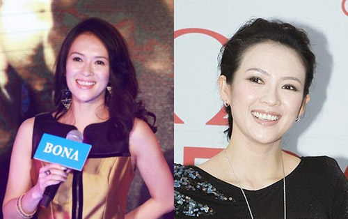 Sao Hoa ngữ đối diện với #039;vấn nạn#039; rụng tóc - 13