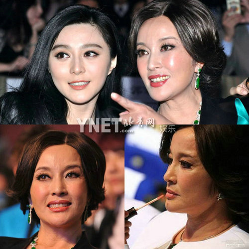 Giật mình với những khuôn mặt méo mó vì PTTM của Sao (P2) - 1