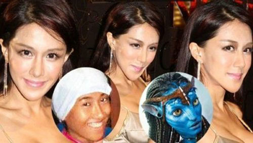 Giật mình với những khuôn mặt méo mó vì PTTM của Sao (P2) - 10