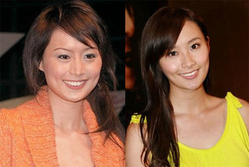 Giật mình với những khuôn mặt méo mó vì PTTM của Sao (P2) - 11