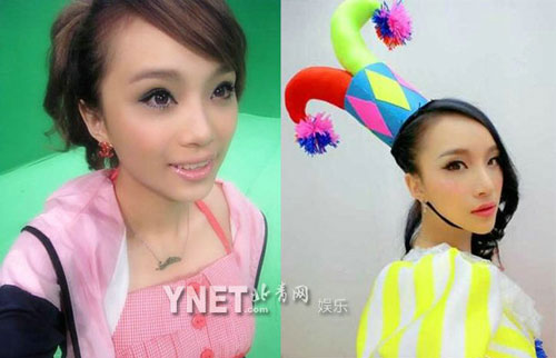 Giật mình với những khuôn mặt méo mó vì PTTM của Sao (P2) - 2