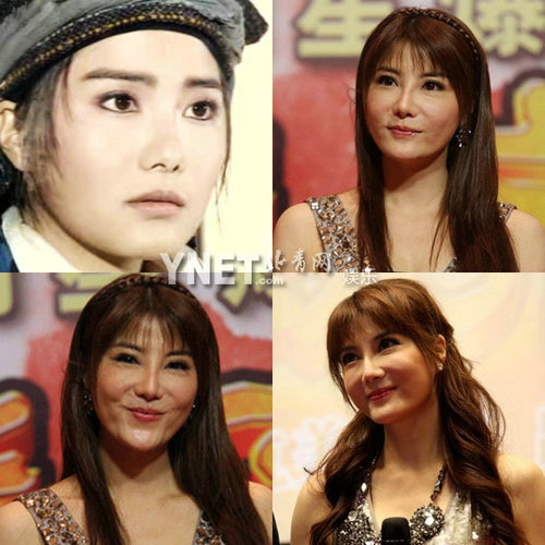 Giật mình với những khuôn mặt méo mó vì PTTM của Sao (P2) - 4