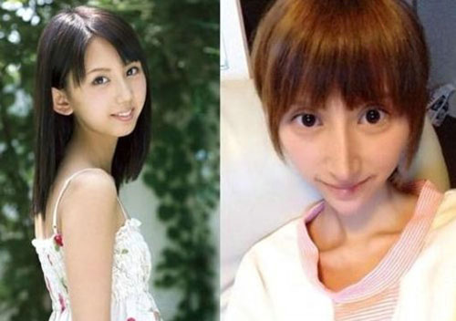 Giật mình với những khuôn mặt méo mó vì PTTM của Sao (P2) - 3