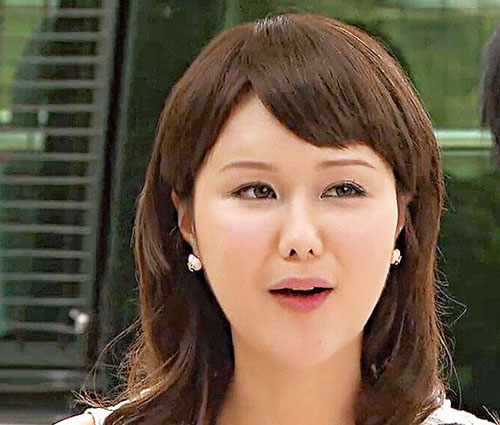 Giật mình với những khuôn mặt méo mó vì PTTM của Sao (P2) - 5