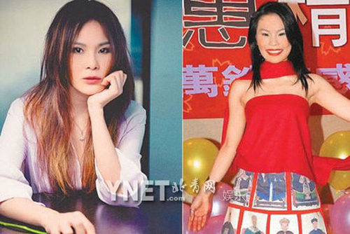 Giật mình với những khuôn mặt méo mó vì PTTM của Sao (P2) - 6