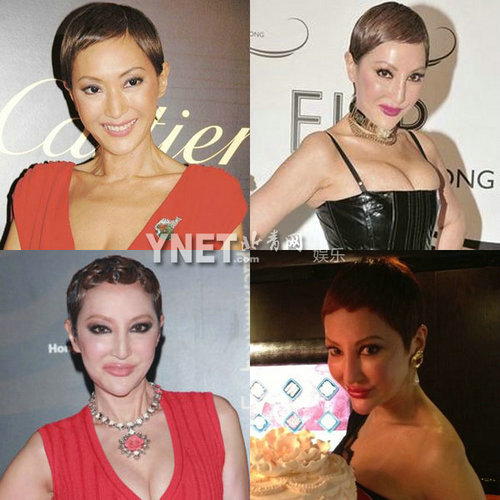 Giật mình với những khuôn mặt méo mó vì PTTM của Sao (P2) - 7