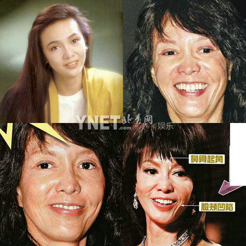 Giật mình với những khuôn mặt méo mó vì PTTM của Sao (P2) - 8