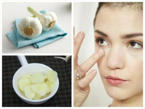 Chiêu đơn giản trị sạch mụn thịt không để lại sẹo - 2