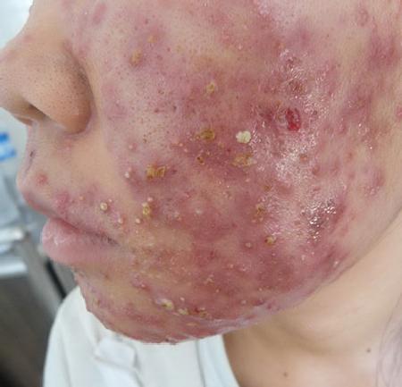 Hãi hùng #039;tiên dược làm đẹp#039; siêu rẻ và những hệ lụy khôn lường - 1