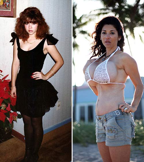 Chi hơn 200 triệu cho bạn gái nâng ngực khủng - 2