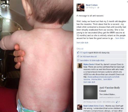 Canada: Cha gửi thư cho #039;hội phản đối tiêm chủng#039; khi con bị sởi - 2