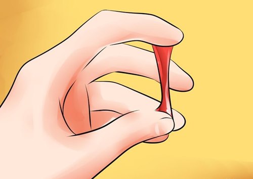 Mách bạn phân biệt dịch âm đạo bất thường - 7