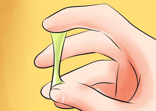 Mách bạn phân biệt dịch âm đạo bất thường - 8