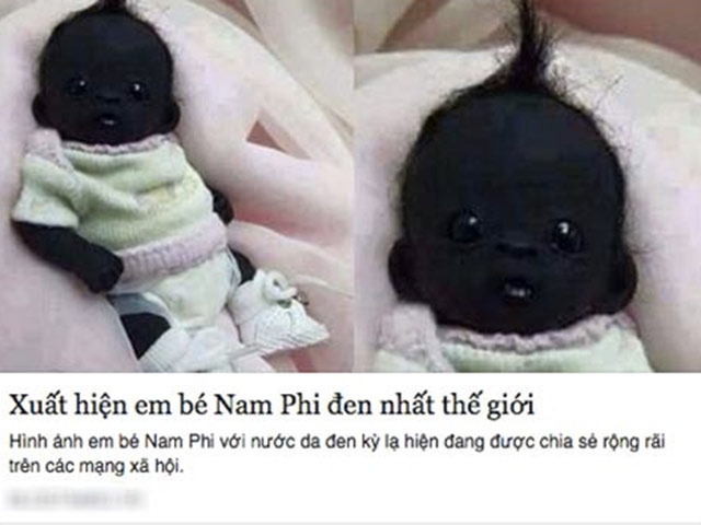 Sự thật gây sốc về em bé Nam Phi đen nhất thế giới