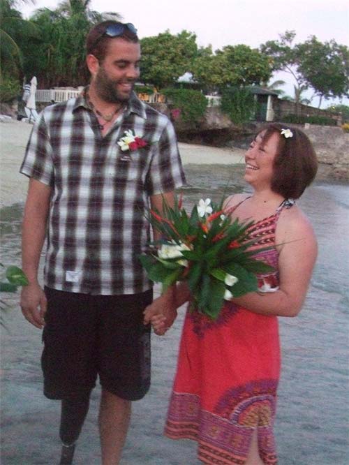 Cầu hôn bằng chiếc nhẫn làm từ... xương chân - 7