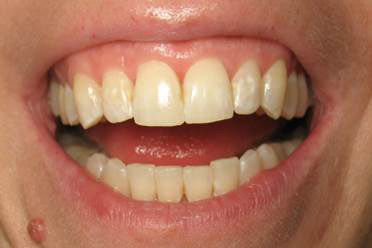 Thèm lắm một nụ cười trọn vẹn - 2