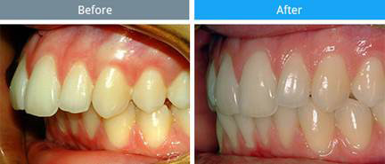 Thèm lắm một nụ cười trọn vẹn - 3