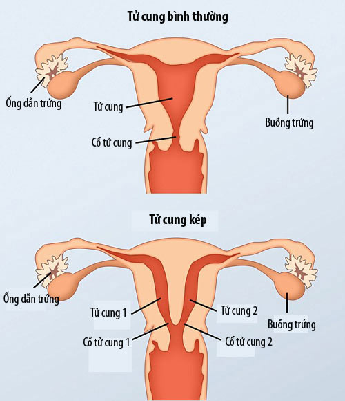 Cô gái có 2 âm đạo, 2 tử cung tiết lộ chuyện mang thai - 1