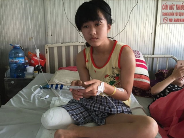 Nữ sinh bị cưa chân phải trả 23 triệu: Bộ Y tế nói gì? - 1