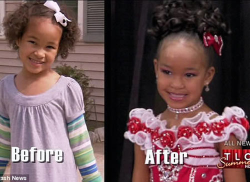 Ép con gái tiêm botox, nhuộm da để thi hoa hậu nhí - 3