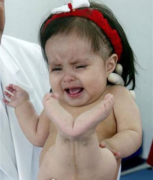 Số phận trái ngược của hai cô bé người cá - 1