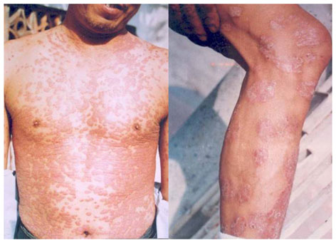 Viên nang nhỏ và những câu chuyện lớn cho lá gan khỏe - 1