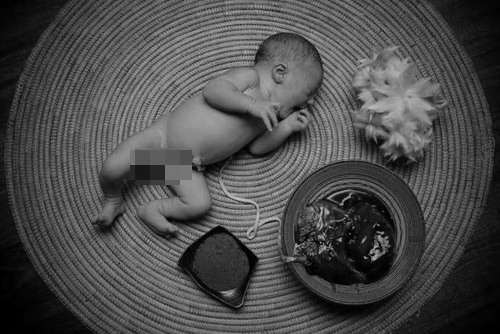 Trào lưu sinh con không cắt dây rốn gây nhiều tranh cãi - 6
