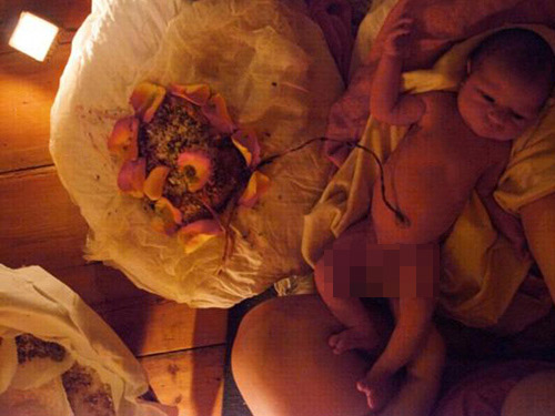Trào lưu sinh con không cắt dây rốn gây nhiều tranh cãi - 7