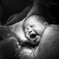 Mẹ cãi lời bác sĩ để chọn đẻ thường sau 2 lần sinh mổ - 2