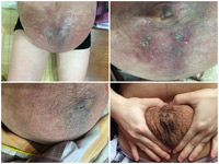 Gặp bà mẹ bỗng nổi tiếng vì bộ ảnh bụng bầu rỉ máu - 2