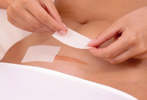 8 điều kiêng kị sau sinh mổ mẹ phải biết - 1