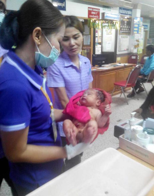 Bé sơ sinh sống sót kỳ diệu ở Thái Lan ngày càng bụ bẫm - 4