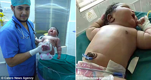 Bà mẹ tuổi teen sinh con gái nặng cân nhất thế giới - 4