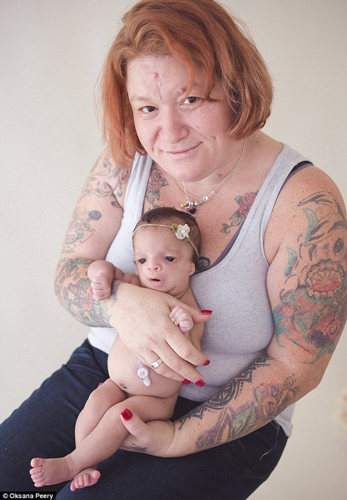 Nuôi con:Mắc bệnh lạ, bé sơ sinh bị từ chối nhận nuôi và cái kết bất ngờ